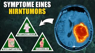 10 Symptome eines Hirntumors, die du niemals ignorieren solltest