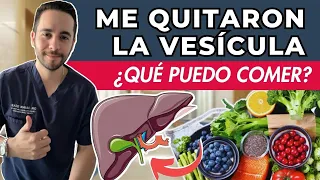 DIETA DESPUÉS DE CIRUGÍA DE VESÍCULA - Alimentos PROHIBIDOS - Cuáles DEBES comer