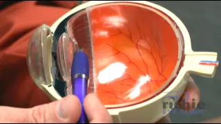 Part 1: Cataract Surgery