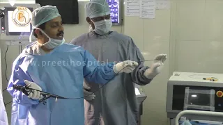 A RIRS   Flexible Scope movements basics - Best Urology & Kidney hospital, hyderabad