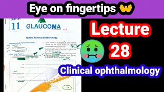 🔴 Glaucoma. clinical Ophthalmology lectures #28. Increased intra ocular pressure of eye 👁‍🗨#glaucoma