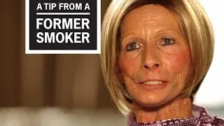 CDC: Tips From Former Smokers - Terrie H.: Little Things I Miss