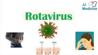 Rotavirus | Risk Factors, Pathophysiology, Symptoms, Diagnosis, Treatment