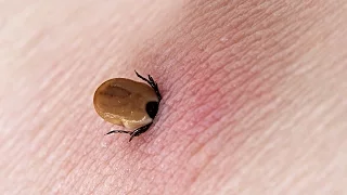 08 Most Painful and Deadliest Insects Bites in The World!