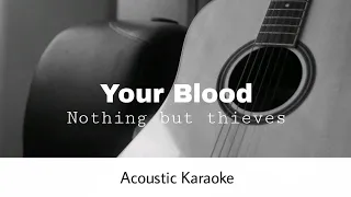 Nothing But Thieves - Your Blood (Acoustic Karaoke)