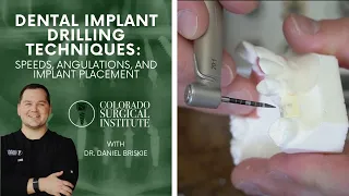 Dental Implant Drilling Techniques: Speeds, Angulations, and Implant Placement