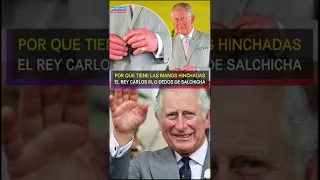 ¿POR QUÉ TIENE LAS MANOS HINCHADAS EL REY CARLOS III, O DEDOS DE SALCHICHA? #reinaisabel #carlosiii