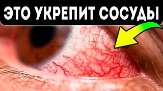 Вот почему сосуды глаз лопаются! 15 домашних способов, которые избавят вас от красных глаз