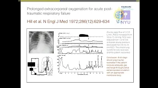 Haemodynamics on ECMO What happens on pump Jan Bakker 2017