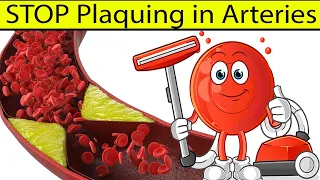1 Healing MINERAL...Reverse Insulin Resistance & Stop Plaquing in Arteries | Dr. Mandell