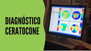 Como é identificado e realizado o diagnóstico do Ceratocone