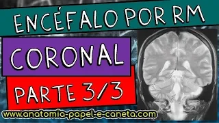 Anatomia radiológica - Encéfalo por RM (Parte 3/3) - CORTE CORONAL