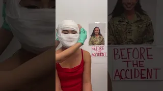 Military woman gets New Face after accident! 😱 #Shorts