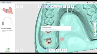 MEDIT New T series Desktop Scanners Basic course (Medit Scan for Labs, Prosthetics)