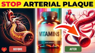 BEST 7 Vitamins To Stop Calcium Plaque In Your Arteries and Heart FAST!