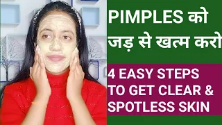 PIMPLES को बोलो Goodbye! It's time to get CLEAR & SPOTLESS Skin/ Indian beauty beats