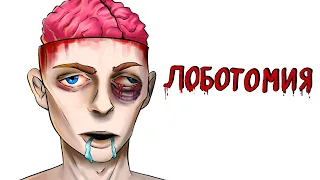 Лоботомия 💉🧠 | Рисованная история (Анимация)