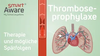 Thromboseprophylaxe: Therapie und mögliche Spätfolgen | Fachfortbildungen in der Pflege | smartAware