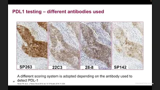 New Paradigms in Lung Cancer Management 17 February 2022 CRSF HCMPL