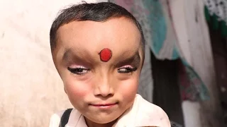 Boy With Mystery Condition Is Worshipped As A God