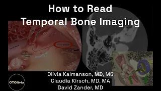 How to Read Temporal Bone Imaging!