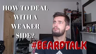 Why Is My Beard Weaker On One Side & What Can I Do to Even Out My Beard? | #BeardTalk | Ep 1