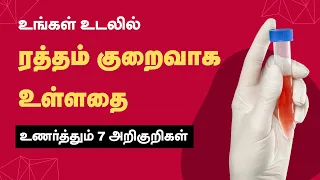 Anemia Symptoms - Low Hemoglobin Level - Iron Deficiency | 24 Tamil Health