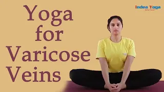 Prevent and cure Varicose Veins with Daily practice of Yoga!