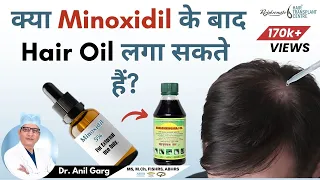 Minoxidil लगाने के बाद Hair Oil लगा सकते है? | Use Oil After Minoxidil | Dr. Anil Garg