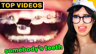 All Your WORST PAINS In One Video  [MUST SEE!] | SSSniperWolf