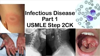 USMLE Step 2CK- Infectious Disease Part 1