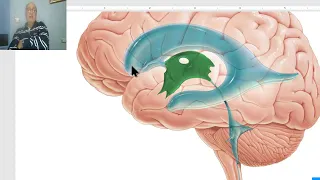 Anatomy for applied medical science(Radiology Department) 5  (Brain Ventricles), by Dr.Wahdan