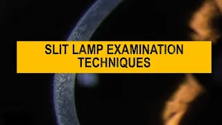 Diffuse v/s Focal | Optical section ,parallel pipe , conical illumination - SLIT LAMP techniques