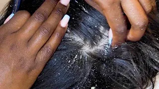 ASMR Scalp Scratching ~ So many tingles💆🏼‍♂️