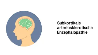 SAE (Subkortikale arteriosklerotische Enzephalopathie) - Psychische Störungebilder