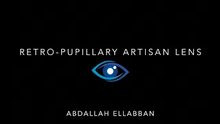 Aphakia Correction - Retropupillary Artisan Lens