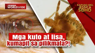 Mga kuto at lisa, kumapit na rin sa pilikmata ng isang pamilya sa Quezon?! | Kapuso Mo, Jessica Soho