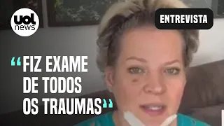 Joice Hasselmann detalha exames após suposto ataque: "Fiz até DNA"