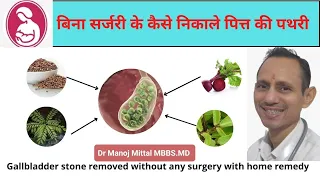 पित्त की थैली की पथरी बिना OPERATION कैसे ठीक करें| घरेलू उपाय|HOME REMEDIES OF GALL BLADDER STONE