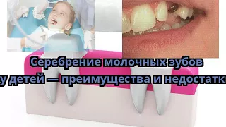 Серебрение молочных зубов у детей — преимущества и недостатки