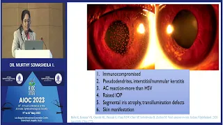 AIOC2023   IC21   topic DR SOMASHEILA  MURTHY I     Viral anterior uveitis   practical tips