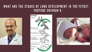 Stages of lung development in the fetus. How does it impact management of the preterm baby?