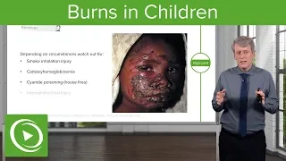 Burns in Children – Pediatrics | Lecturio