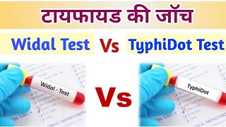 Widal Test vs TyphiDot Test | Widal Test in Hindi | TyphiDot Test in Hindi | Typhoid Test in Hindi