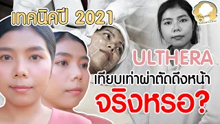 ตัดสินใจทำ ULTHERA ครั้งแรก! ยกกระชับใบหน้า เทียบเท่ากันผ่าตัด  I รีวิวลูกสาวหมอ sowon clinic EP.122