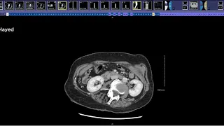 How to read a pancreas CT