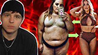 Weight Loss Surgery NIGHTMARE | WokeUpLikeDez