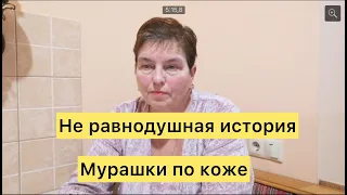 Не равнодушная история. Мурашки по коже.