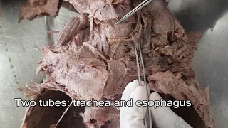 Thyroid gland - Dissection