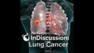 S2 Episode 1: Are We Ready to Use the Word "Cure" When Talking About Small Cell Lung Cancer Treat...
